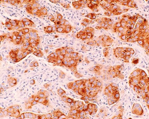 Российские-учёные-сделают-лечение-рака-безопасней