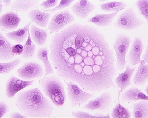 Российский-аппарат-для-обнаружения-рака-испытают-во-второй-половине-2025-года