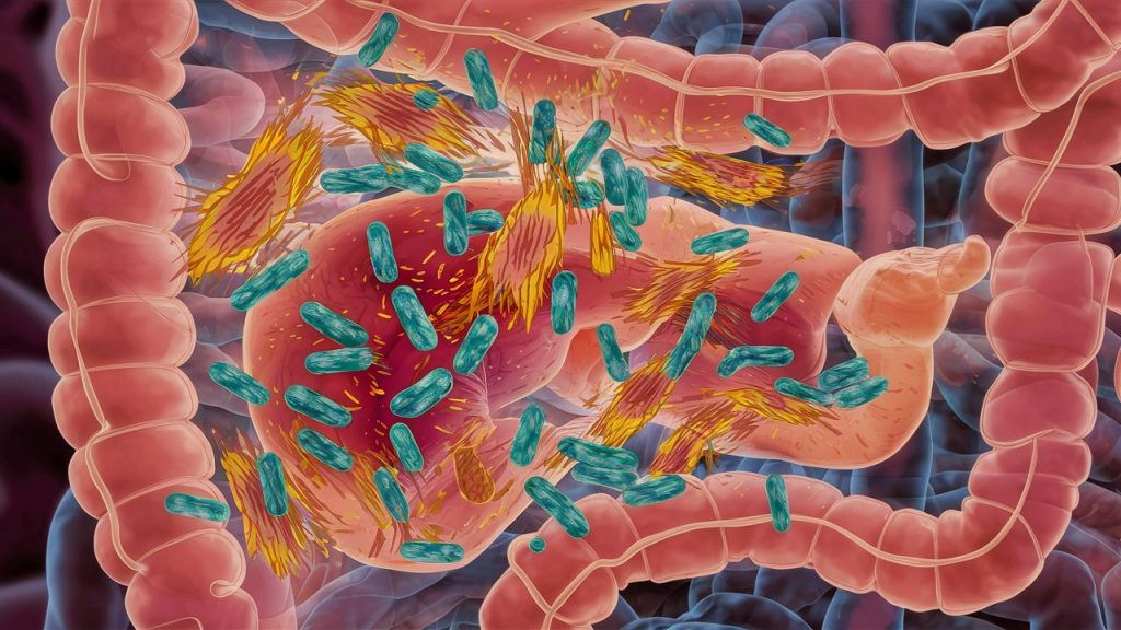 Пересадка-кала-помогла-в-борьбе-с-алкогольной-зависимостью