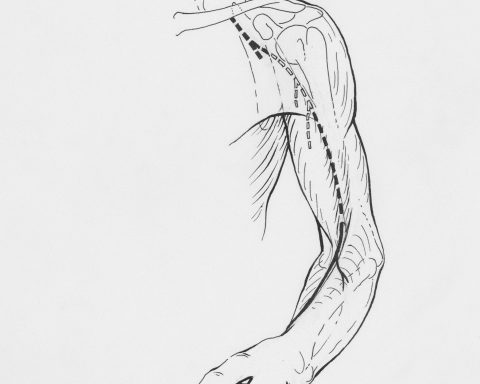 Травматолог:-черепно-мозговые-травмы-и-даже-простые-ушибы-создают-риск-инвалидности