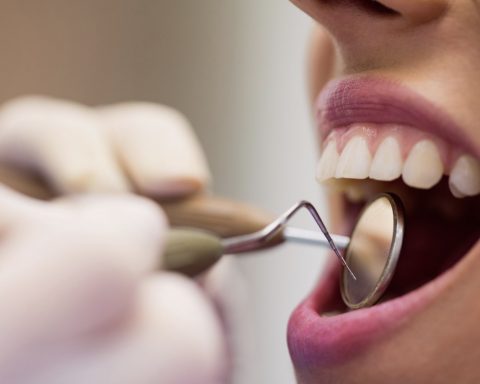 Стоматолог-предупредила-о-риске-аллергии-из-за-наращивания-зубов-гель-лаком