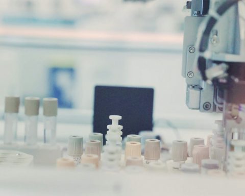 В-США-регулятор-одобрил-исследования-крови-для-диагностики-болезни-Альцгеймера