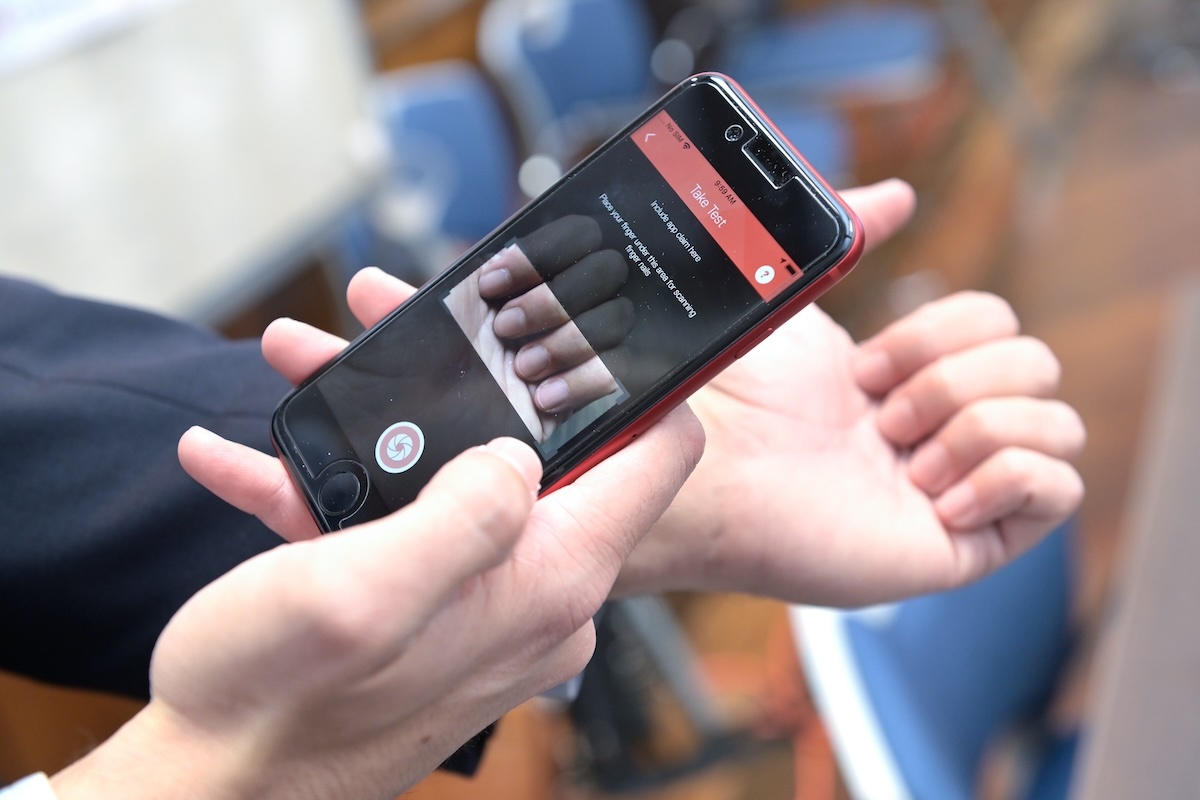 Приложение-для-смартфона-научили-диагностировать-болезнь-крови-по фото-ногтей