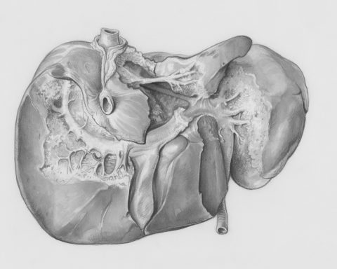 Российские-учёные-разработают-тесты-для-раннего-определения-рака-печени