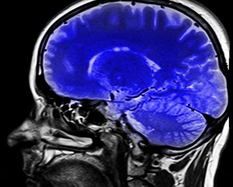 Крики-и-размахивание-руками-во-сне-назвали-возможными-признаками-тяжёлой-деменции