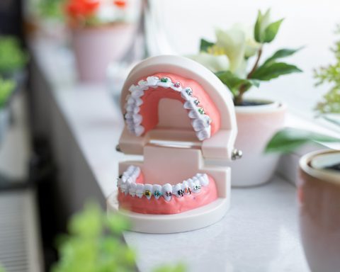 Стоматолог-назвал-последствия-установки-резцов-и наращивания-клыков-как-в tiktok