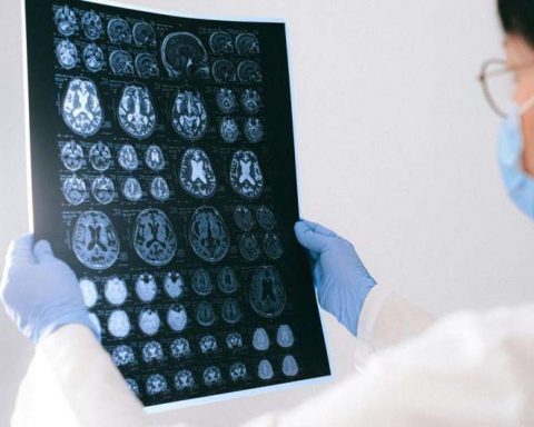 Учёные-выяснили,-что-физические-упражнения-помогают-поддерживать-объём-мозга