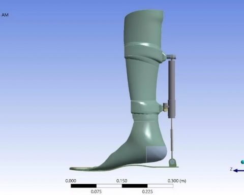 Ростовские-учёные-создали-устройство-для-восстановления-ног-после-травм