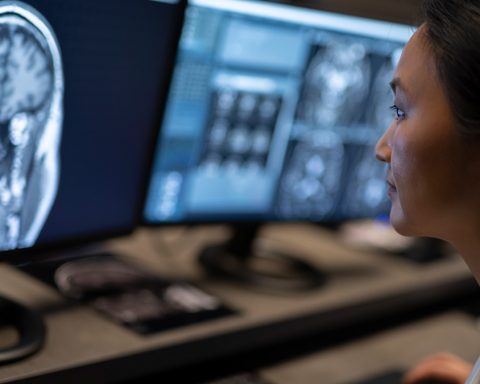 Врачи-порекомендовали-есть-меньше-натрия-для-снижения-риска-инсульта