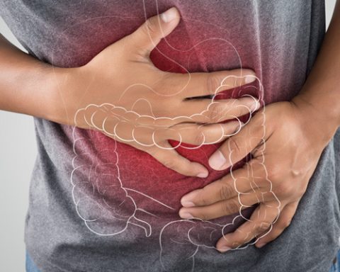 nutritionists-recommended-that-the-irritated-bowel-syndrome-is-slower