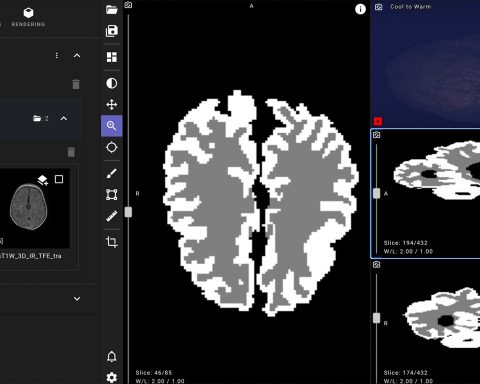 Яндекс-создал-нейросеть-для-ранней-диагностики-ДЦП-у младенцев
