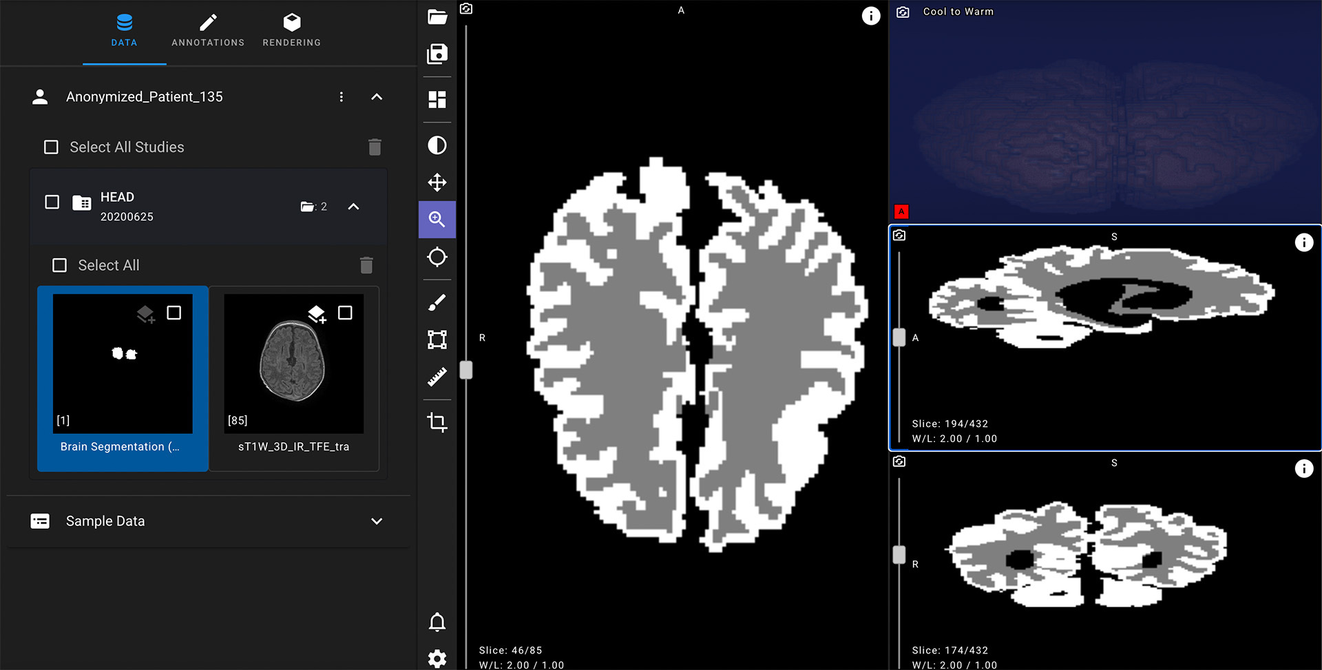 Яндекс-создал-нейросеть-для-ранней-диагностики-ДЦП-у младенцев